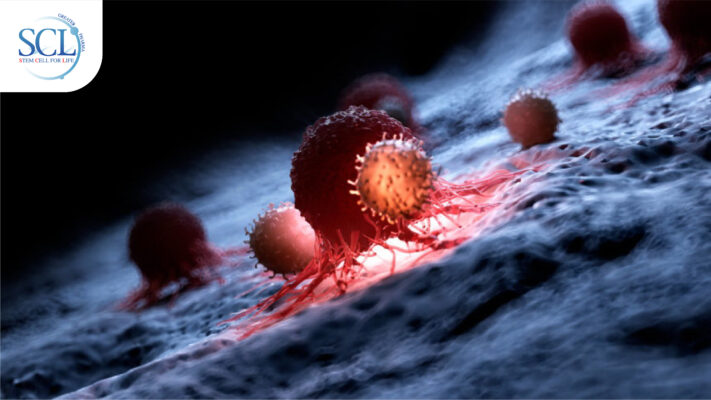 Nk Cell - Stemcellforlife